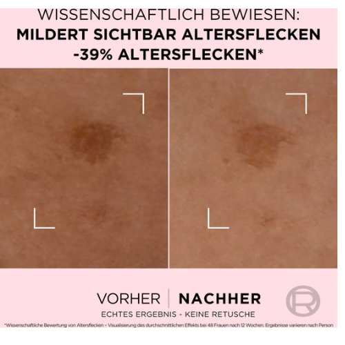 L'Oréal Parijs Age Perfect serum tegen ouderdomsvlekken 30ml